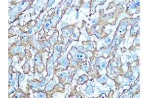 Immunohistochemistry of paraffin-embedded Rat placenta using GLUT1/SLC2 antibody (ABIN6129475, ABIN6147954, ABIN6147956 and ABIN6222743) at dilution of 1:100 (40x lens). (GLUT1 Antikörper  (AA 210-310))