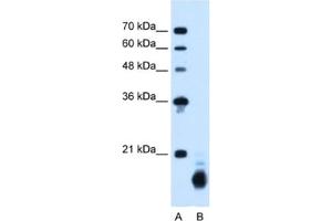Western Blotting (WB) image for anti-Cyclophilin B (PPIB) antibody (ABIN2462813) (PPIB Antikörper)