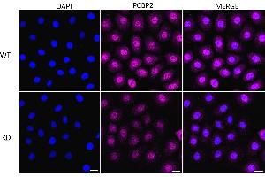 Immunocytochemical staining of HeLa cells using PCBP2 antibody (ABIN7799871), 1:1,000), Top panel: wild-type (WT), Bottom panal: PCBP2 shRNA knockdown (KD).