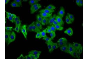 Immunofluorescence staining of HepG2 cells with ABIN7163104 at 1:133, counter-stained with DAPI. (PHEX Antikörper  (AA 524-673))