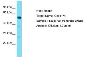 Host: Rabbit Target Name: Ccdc174 Sample Type: Rat Pancreas lysates Antibody Dilution: 1. (CCDC174 Antikörper  (Middle Region))