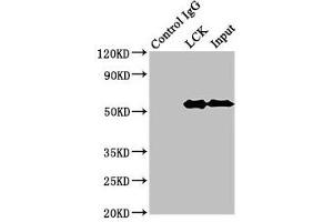 Immunoprecipitating LCK in Jurkat whole cell lysate Lane 1: Rabbit control IgG (1 μg) instead of ABIN7174038 in Jurkat whole cell lysate. (LCK Antikörper  (AA 1-539))