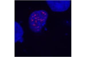 Fig. (DDDDK Tag Antikörper)