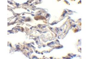 Immunohistochemistry of cIAP in human lung cells with cIAP antibody at 10 μg/ml.