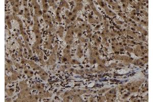 ABIN6265740 and ABIN6273021 at 1/100 staining Human liver tissue by IHC-P. (TRIM44 Antikörper  (Internal Region))
