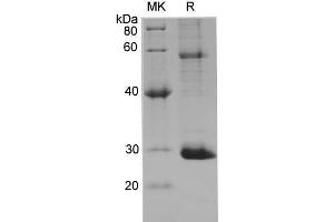 Western Blotting (WB) image for V-Akt Murine Thymoma Viral Oncogene Homolog 1 (AKT1) protein (His tag) (ABIN7320869) (AKT1 Protein (His tag))