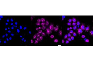 Immunocytochemical staining of HepG2 cells with Aromatase antibody (ABIN7798252), 1:1,000).