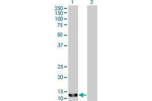 Western Blot analysis of STK10 expression in transfected 293T cell line by STK10 MaxPab polyclonal antibody. (STK10-A Antikörper  (AA 12-144))