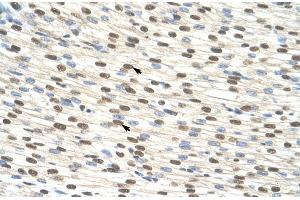 Human Heart; ZNF274 antibody - N-terminal region in Human Heart cells using Immunohistochemistry