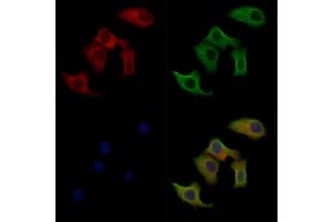 Phospho-RIPK3 (Ser199) Antibody staining Hela cells(heat shock treatment) by IF/ICC.