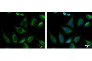 ICC/IF Image PRKCSH antibody [N1C1] detects PRKCSH protein at endoplasmic reticulum by immunofluorescent analysis. (PRKCSH Antikörper)