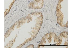 Immunoperoxidase of purified MaxPab antibody to ACPP on formalin-fixed paraffin-embedded human prostate. (ACPP Antikörper  (AA 1-386))