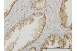 Immunoperoxidase of purified MaxPab antibody to ACPP on formalin-fixed paraffin-embedded human prostate.