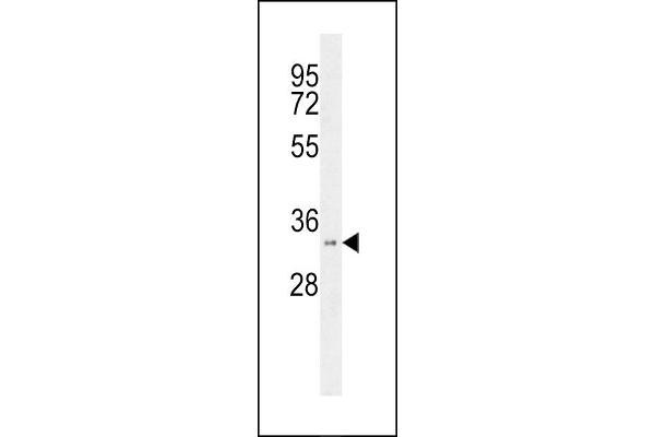HSD17B11 Antikörper  (N-Term)