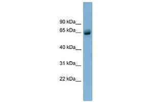 SLFN12 antibody used at 1 ug/ml to detect target protein. (SLFN12 Antikörper  (N-Term))