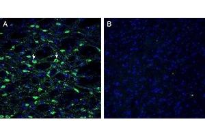 Expression of Histamine H1 Receptor in mouse substantia nigra - Immunohistochemical staining of perfusion-fixed frozen mouse brain sections with Anti-Histamine H1 Receptor/HRH1 Antibody (extracellular) (ABIN7043269, ABIN7044512 and ABIN7044513), (1:300), followed by goat anti-rabbit-AlexaFluor-488. (HRH1 Antikörper  (2nd Extracellular Loop))
