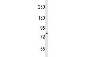 IKK antibody western blot analysis in A549 lysate. (IKK-alpha /IKK-beta Antikörper  (AA 155-184))
