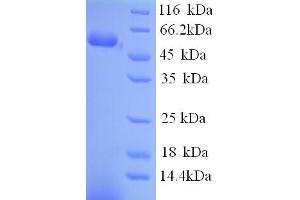 SDS-PAGE (SDS) image for Vimentin (VIM) (AA 2-466) protein (His tag) (ABIN7478956) (Vimentin Protein (VIM) (AA 2-466) (His tag))
