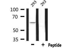 Western blot analysis of extracts from 293, using CERKL Antibody.