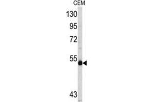 Western blot analysis of MYCN antibody (C-term) in CEM cell line lysates (35ug/lane). (MYCN Antikörper  (C-Term))