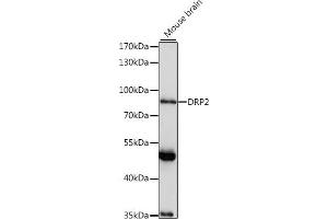 Western blot analysis of extracts of mouse brain, using DRP2 antibody (ABIN7266872) at 1:1000 dilution. (DRP2 Antikörper  (AA 1-240))