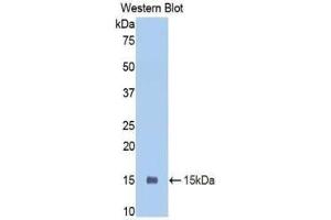 Western blot analysis of the recombinant protein. (PIGR Antikörper  (AA 352-457))
