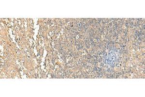 Immunohistochemistry of paraffin-embedded Human tonsil tissue using NARS Polyclonal Antibody at dilution of 1:55(x200) (NARS Antikörper)