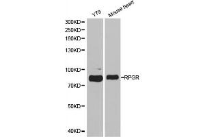 Western blot analysis of extracts of various cell lines, using RPGR antibody. (RPGR Antikörper)