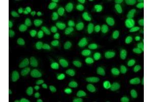 Immunofluorescent staining of HeLa cells using anti-FGFR2 mouse monoclonal antibody (ABIN2454529). (FGFR2 Antikörper)
