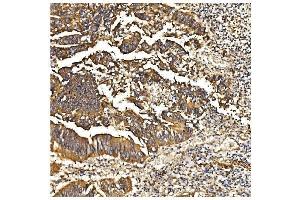 IHC analysis of PDE6 beta/PDE6B using anti-PDE6 beta/PDE6B antibody (ABIN7600894). (PDE6B Antikörper  (AA 25-237))