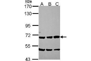 WB Image Sample (30 ug of whole cell lysate) A: NT2D1 B: IMR32 C: U87-MG 7. (SCG2 Antikörper)