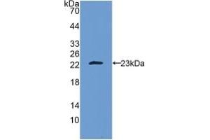 Detection of Recombinant IL10, Human using Polyclonal Antibody to Interleukin 10 (IL10) (IL-10 Antikörper  (AA 19-178))