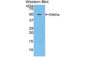 Detection of Recombinant ITGa5, Human using Polyclonal Antibody to Integrin Alpha 5 (ITGa5) (ITGA5 Antikörper  (AA 895-1049))