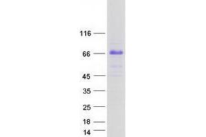 TRIM55 Protein (Transcript Variant 3) (Myc-DYKDDDDK Tag)