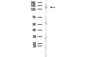 Western blot analysis of lysates from Rat brain, using JMY Antibody at 1/1000 dilution.