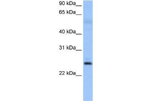 WB Suggested Anti-ROPN1B Antibody Titration: 0. (ROPN1B Antikörper  (N-Term))