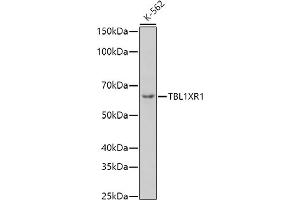 Western blot analysis of extracts of K-562 cells, using TBL1XR1 antibody (ABIN6132717, ABIN6148893, ABIN6148895 and ABIN6217436) at 1:1000 dilution. (TBL1XR1 Antikörper  (AA 1-180))