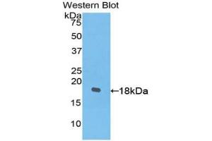 Western blot analysis of the recombinant protein. (PDGFC Antikörper  (AA 235-345))