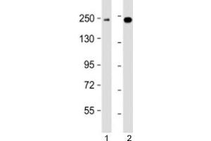 Western blot testing of human 1) K562 and 2) MCF7 cell lysate with XRN1 antibody at 1:2000. (XRN1 Antikörper  (AA 1455-1706))
