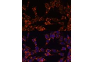 Immunofluorescence (IF) image for anti-Ubiquitin-Conjugating Enzyme E2F (UBE2F) (AA 1-185) antibody (ABIN6149794)