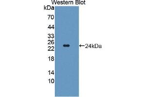 Western blot analysis of the recombinant protein. (TWSG1 Antikörper  (AA 26-223))