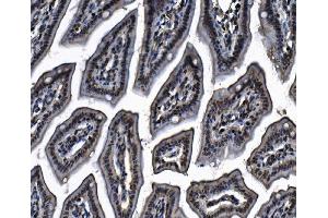 IHC analysis of MCM4 using anti-MCM4 antibody (ABIN7601485). (MCM4 Antikörper  (AA 361-677))