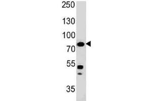 Western blot testing of human HT29 cell lysate with Moesin antibody (clone MSN/491). (Moesin Antikörper)