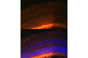 Immunofluorescence analysis of mouse retina using GRK1 Polyclonal Antibody (ABIN6134352, ABIN6141414 and ABIN7101798) at dilution of 1:100 (40x lens). (GRK1 Antikörper  (AA 1-160))
