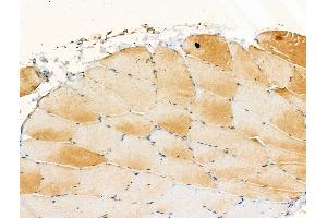 Phospho-A20/TNFAIP3 (Ser381) Antibody at 1/100 staining Rat muscle tissue by IHC-P. (TNFAIP3 Antikörper  (pSer381))