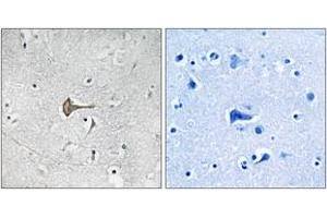 Immunohistochemistry analysis of paraffin-embedded human brain tissue, using Kv4. (KCND2 Antikörper  (AA 581-630))