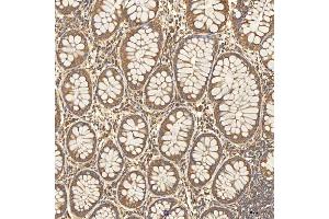IHC analysis of Citrin/SLC25A13 using anti-Citrin/SLC25A13 antibody (ABIN7599512). (slc25a13 Antikörper  (AA 1-643))