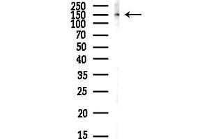 Western blot analysis of lysates from HUVEC cells(LPS,4h treatment), using Phospho-PERK (Ser715) Antibody at 1/1000 dilution.