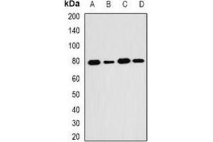 Western blot analysis of SH2B1 expression in HT29 (A), MCF7 (B), mouse kidney (C), mouse brain (D) whole cell lysates.