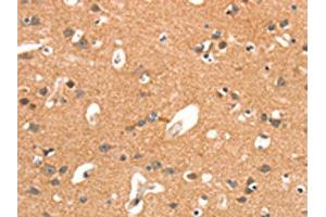 The image on the left is immunohistochemistry of paraffin-embedded Human brain tissue using ABIN7189890(ARHGAP4 Antibody) at dilution 1/25, on the right is treated with synthetic peptide. (ARHGAP4 Antikörper)